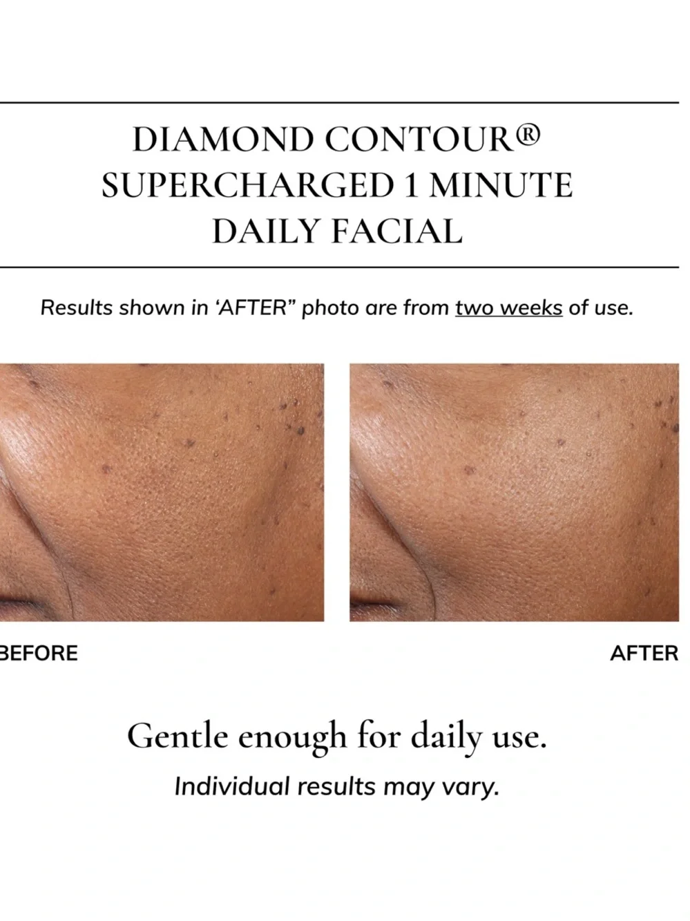 Kaplan MD Diamond Contour 1 Minute Daily Rejuvenating Facial Elixir 1.35/40ml